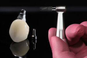 a single dental implant with a dentist holding up a tool to place it